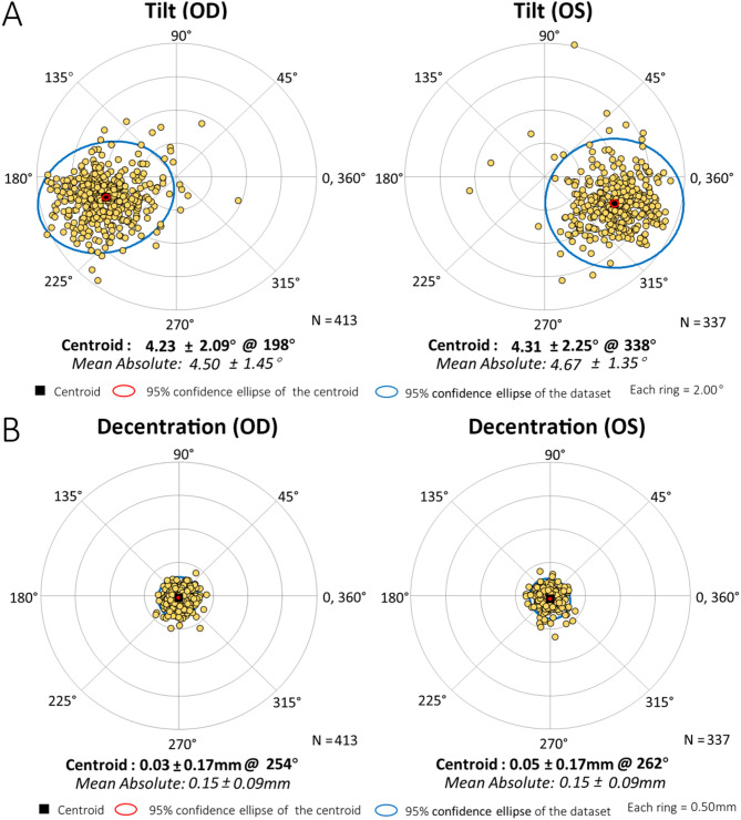 Lens tilt and decentration in a Chinese population with age-related cataracts and their influencing factors.