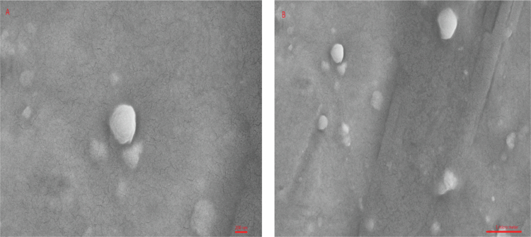 Antifungal efficacy of caffeic acid and nano-caffeic acid particles against candidiasis: an <i><b>in vitro</b></i> study.