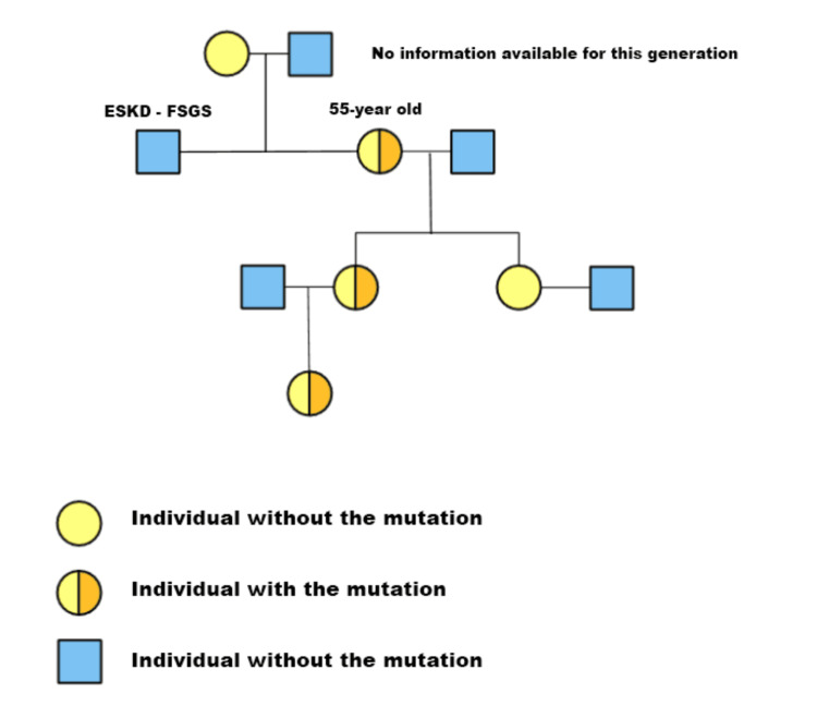 An Elusive Diagnosis of Autosomal Dominant Alport Syndrome: Genomic Sequencing Is a Game Changer.