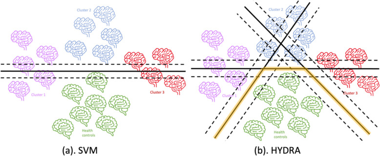 Dissecting real-world memory clinical cohort heterogeneity: analysis of neuroanatomical subtypes using HYDRA.
