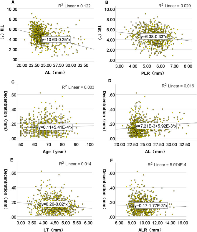 Lens tilt and decentration in a Chinese population with age-related cataracts and their influencing factors.