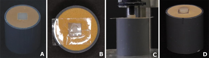 The Effect of Cement Thickness on Shear Bond Strength of Zirconia with Three Different Self-Adhesive Resin Cements.