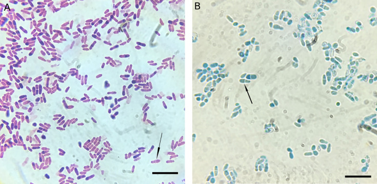 Photo Quiz: Unexpected yeast in a premature infant-pathogen or passenger.