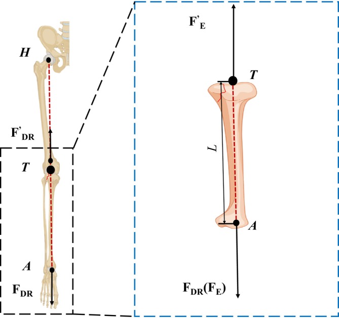 Equilibrium Mechanics in Fracture Reduction of Tibial Plateau.