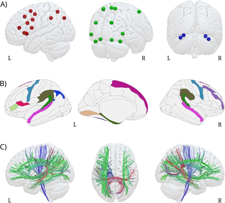 Multimodal investigation of the neurocognitive deficits underlying dyslexia in adulthood.