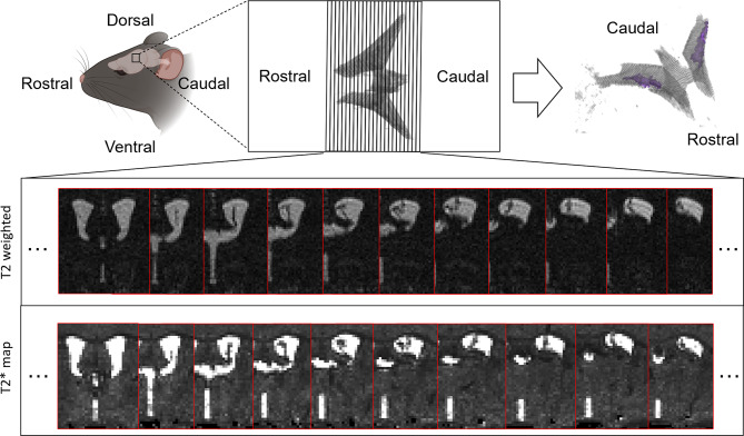 Evidence for reduced choroid plexus volume in the aged brain.