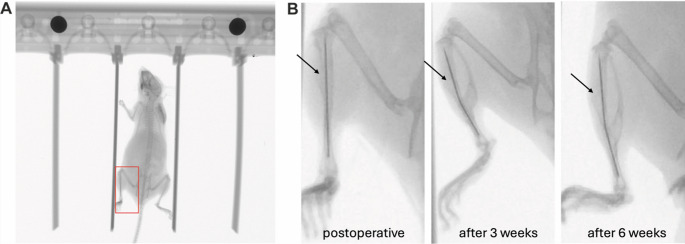 Minimal invasive open tibial fracture model in mice.