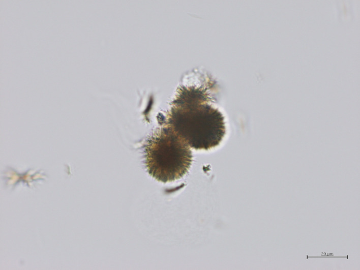 Renal and gastrointestinal complications following tosufloxacin therapy for suspected mycoplasma infection in a 10-year-old child.