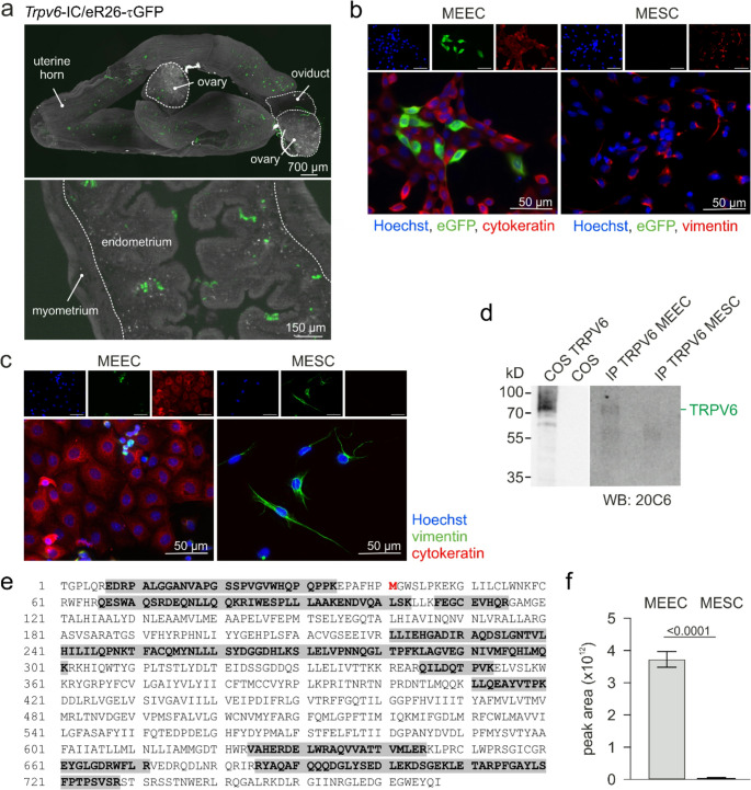 TRPV6 channel function is involved in endometrial epithelial cell Ca<sup>2+</sup> signaling and female mouse fecundity.