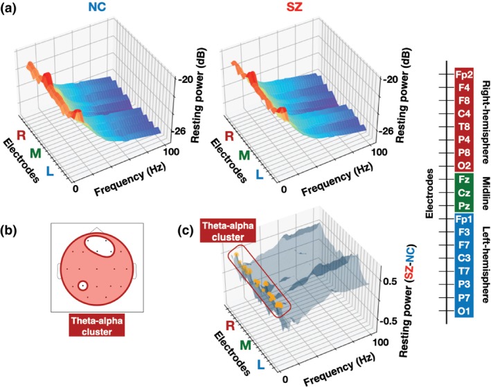 Abnormal spontaneous activity and rest-task shift in schizophrenia.