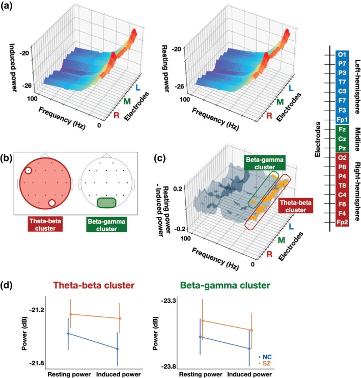 Abnormal spontaneous activity and rest-task shift in schizophrenia.