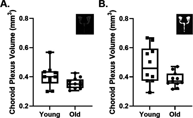 Evidence for reduced choroid plexus volume in the aged brain.