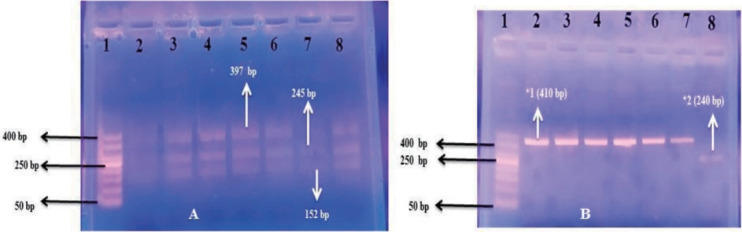 Adenosine deaminase and interleukin-1 receptor antagonist genetic polymorphisms among obese children with versus without metabolic dysfunction-associated fatty liver disease.