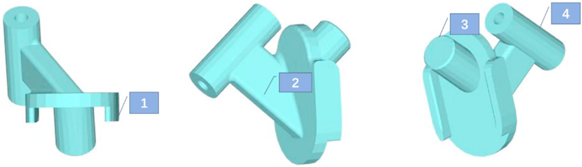 3D-printed navigation-guided FNS-CCS fixation reduces complications in young adults with comminuted femoral neck fractures: a retrospective cohort study.