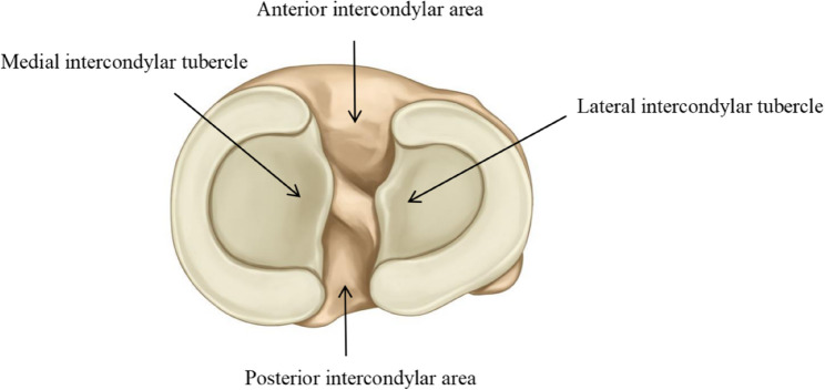 A new CT-based classification system for posterior cruciate ligament tibial avulsion fractures: a nationwide multicenter study.