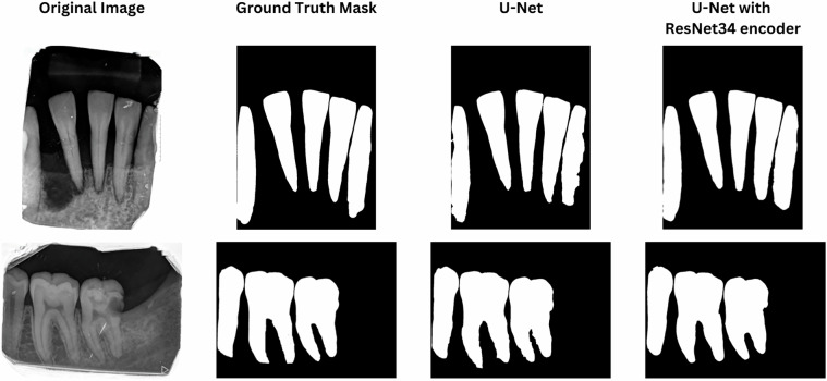DenPAR: Annotated Intra-Oral Periapical Radiographs Dataset for Machine Learning.