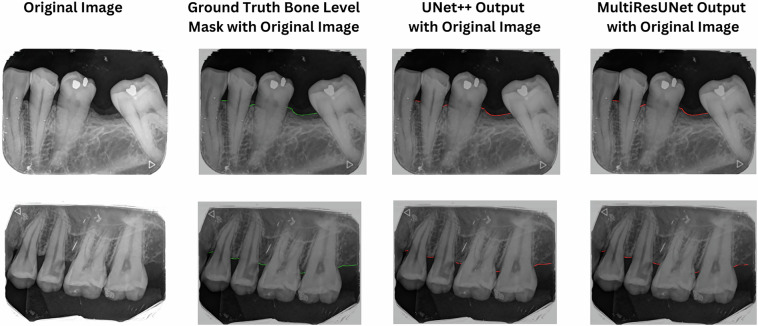 DenPAR: Annotated Intra-Oral Periapical Radiographs Dataset for Machine Learning.
