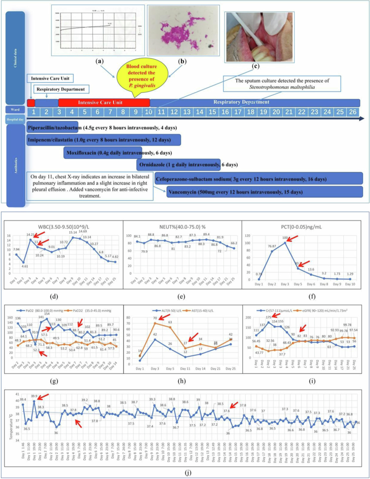 Sepsis and septic shock caused by <i>Porphyromonas gingivalis</i>: a case report.