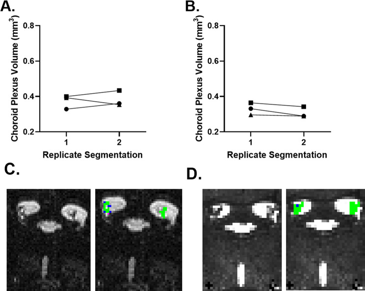 Evidence for reduced choroid plexus volume in the aged brain.