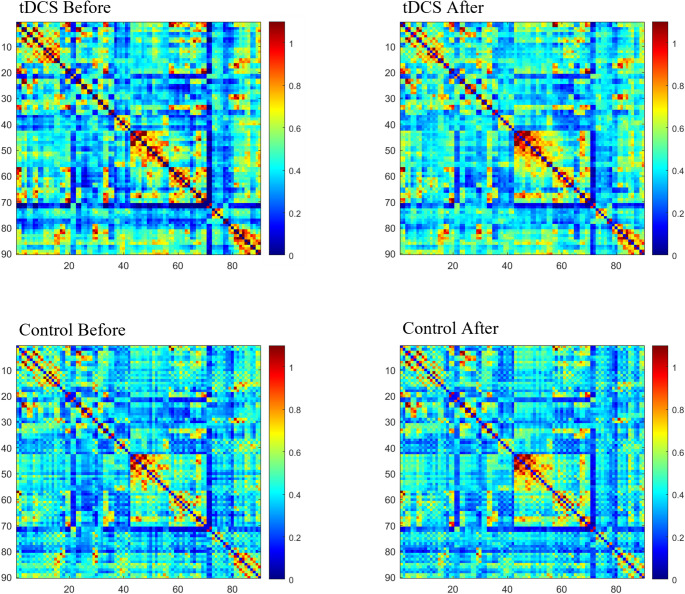 The impact of transcranial direct current stimulation on brain network connectivity and topology in post-stroke cognitive impairment patients: a resting-state fMRI study.