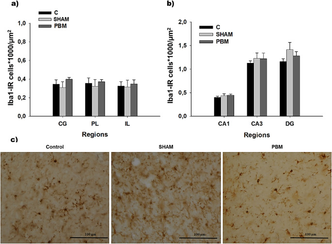 Safety of 810 nm photobiomodulation in the developing brain: no evidence of glial reactivity or pro-inflammatory cytokine expression in rats.
