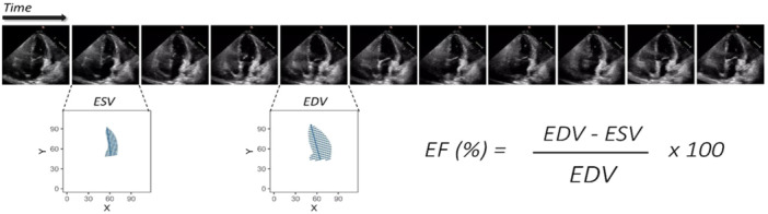 Deep Learning for Early Detection of Cardiovascular Diseases From Medical Imaging.