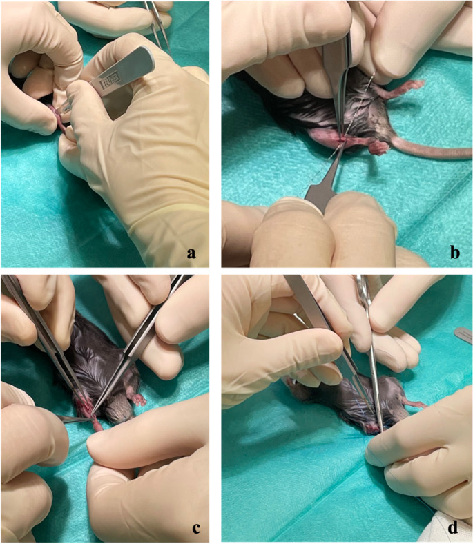 Minimal invasive open tibial fracture model in mice.