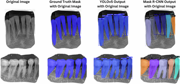 DenPAR: Annotated Intra-Oral Periapical Radiographs Dataset for Machine Learning.