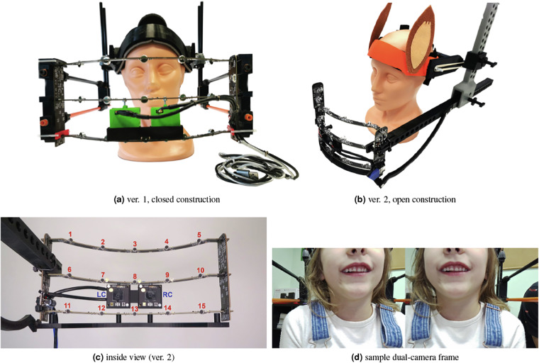 Polish multichannel audio-visual child speech dataset with double-expert sigmatism diagnosis.
