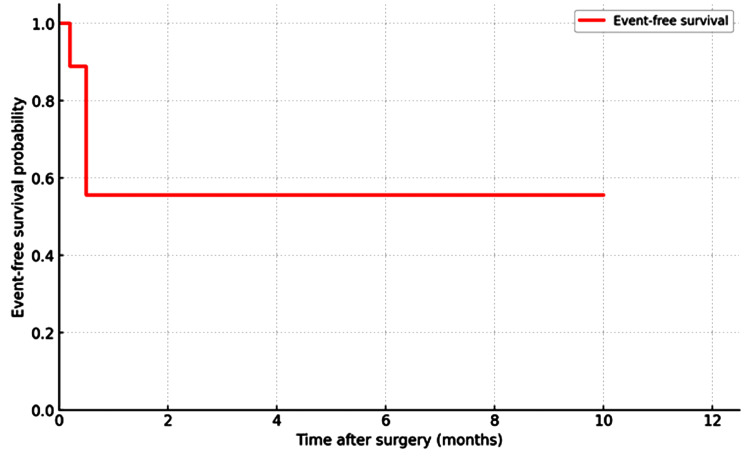 Early Thoracotomy and Decortication in Pleural Empyema.