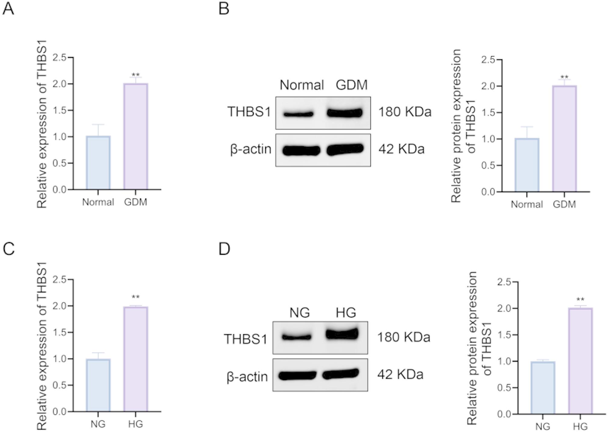 THBS1 regulates the function and insulin sensitivity of HTR8/SVneo cells treated with high glucose through the RhoA/ROCK1 signaling pathway.