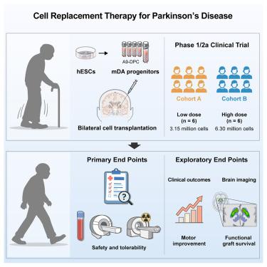 Phase 1/2a clinical trial of hESC-derived dopamine progenitors in Parkinson’s disease