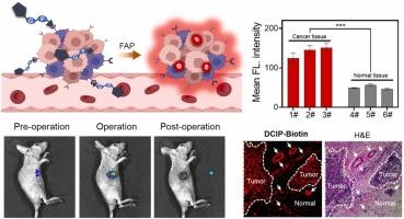 Biotin-guided NIR fluorescent probe for in situ imaging of fibroblast activation protein in human breast cancer tissues
