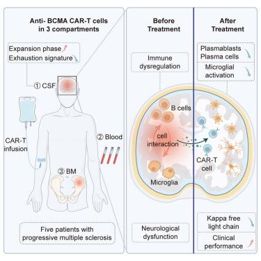 Anti-BCMA CAR-T therapy in patients with progressive multiple sclerosis
