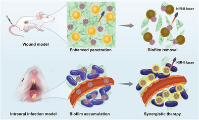 AIE-Powered Nanosoldiers for Precision Disruption of Biofilm's Extracellular Defense in Infection Treatment