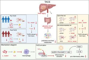 Microbial metabolism dysfunction induced by transarterial chemoembolization aggravates postprocedural liver injury in HCC