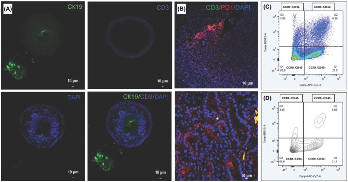 Therapeutic applications of a novel humanized monoclonal antibody targeting chemokine receptor CCR9 in pancreatic cancer.