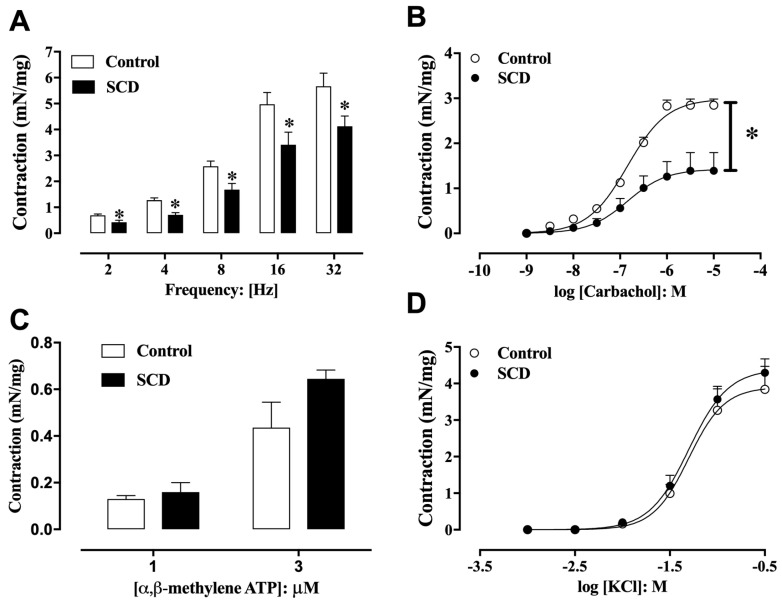 Bladder Dysfunction in Sickle Cell Disease Is Associated with Inflammation and Oxidative Stress.