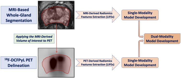 [18F]F-DCFPyL PET/MRI radiomics for intraprostatic prostate cancer detection and metastases prediction using whole-gland segmentation.
