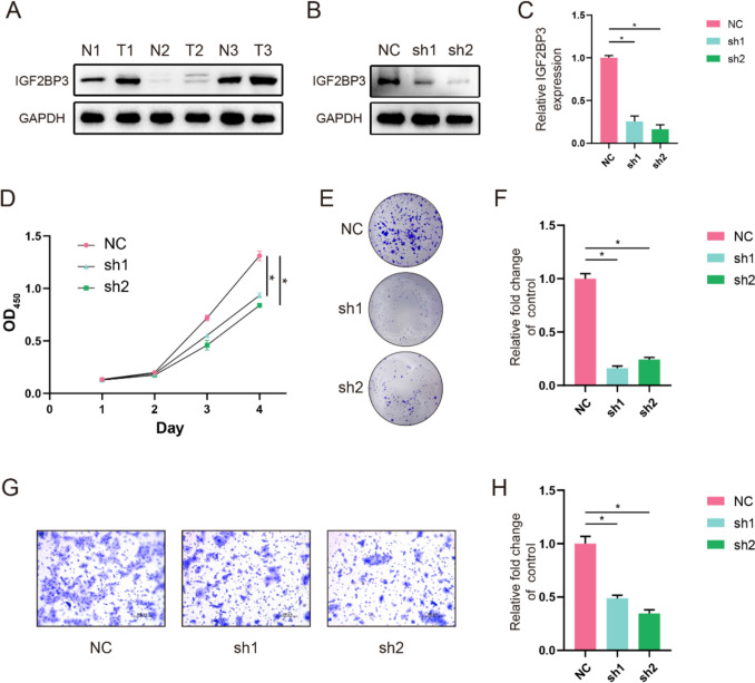 Deciphering the crucial role of IGF2BP3 in modulating stemness traits of salivary adenoid cystic carcinoma.