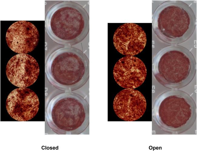 Characterization of human skeletal stem cells in closed and open tibia fractures: a single center pilot study.