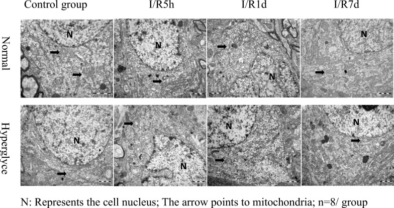 Effects of different reperfusion durations on neuronal mitochondrial ultrastructure following cerebral ischemia in diabetic rats: a transmission electron microscopy study.