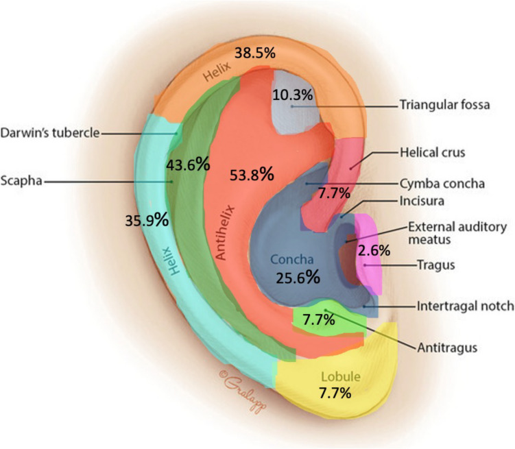 Surgical outcome following primary closure of auricular lacerations.