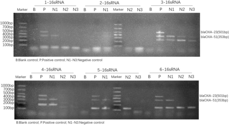 Development and clinical application of a PCR-UV assay for detection of carbapenem resistant Acinetobacter baumannii in bloodstream infections.