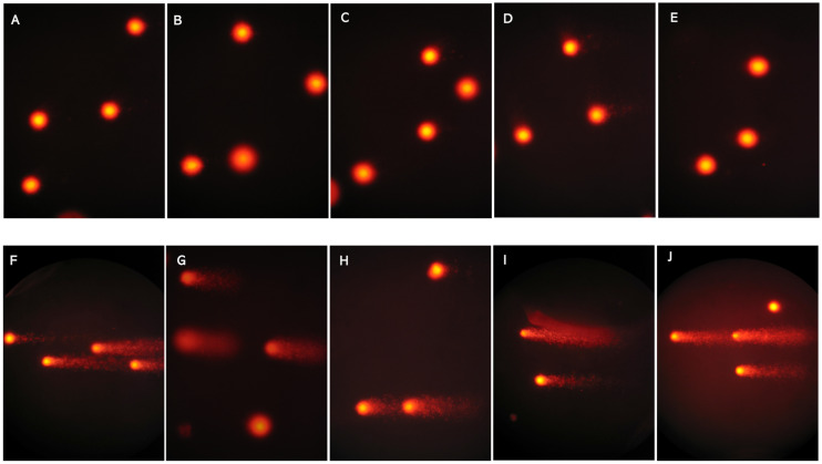 Single Nucleotide Polymorphisms in Oxidative Stress-Related Genes Are Associated with Autism Spectrum Disorders.