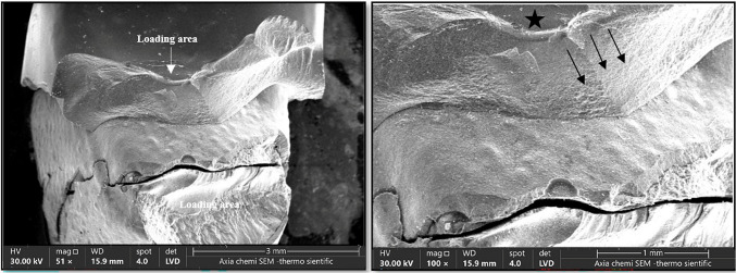 Post fatigue fracture resistance of lithium disilicate and zirconia crowns: vertical versus horizontal preparations (an in vitro study).