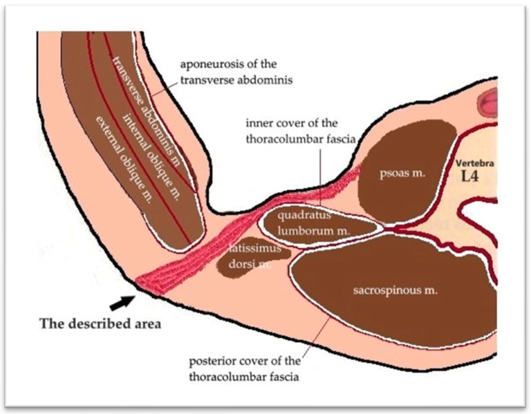 Giant Bilateral Iliopsoas Abscesses, Secondary to Pott's Disease: Challenging Diagnostic-Therapeutic Protocol Management (Modern and Innovative Open Approach Technique Through J.L. Petit Triangle)-A Case Report and Literature Review.