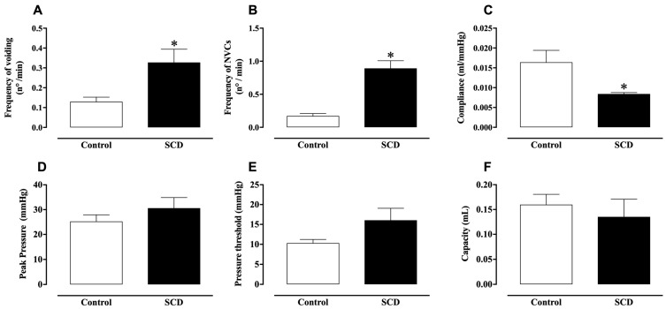 Bladder Dysfunction in Sickle Cell Disease Is Associated with Inflammation and Oxidative Stress.
