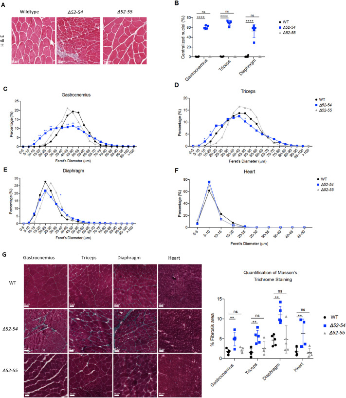 Generation and characterization of a mouse model of Becker muscular dystrophy with a deletion of Dmd exons 52 to 55.