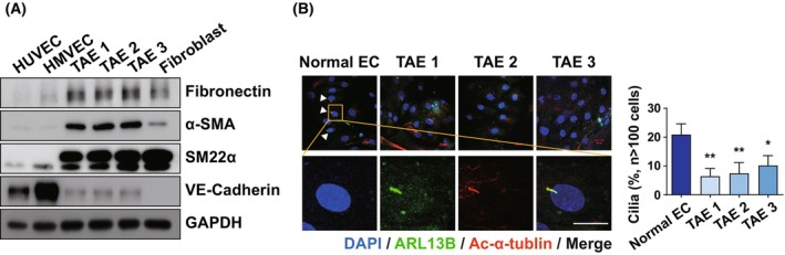 Loss of primary cilia promotes EphA2-mediated endothelial-to-mesenchymal transition in the ovarian tumor microenvironment.